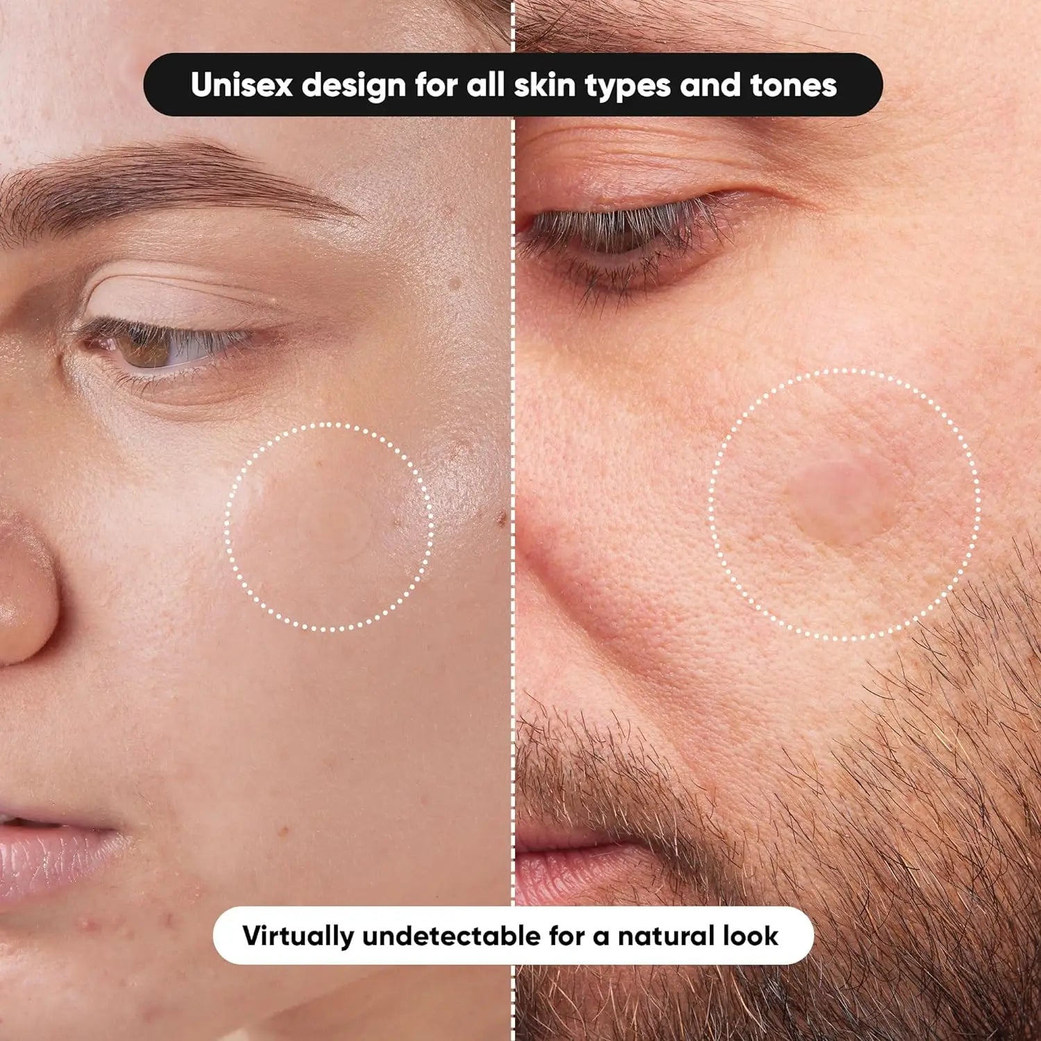 Elyssiora Invisible Hydrocolloid Acne Patches